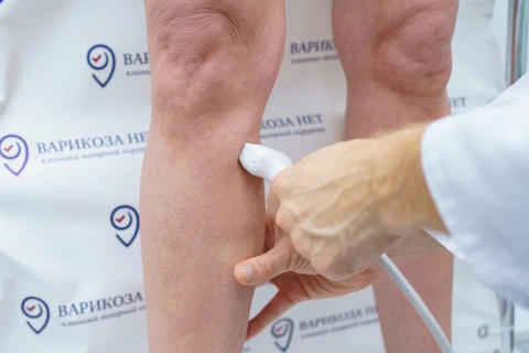 Какие изменения вен могут скрываться за сосудистыми звездочками