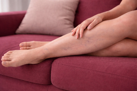 Гормональные препараты и риск варикоза